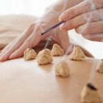 Moxibustione: Il Calore dell’Artemisia nella Medicina Tradizionale Cinese