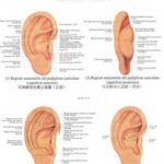Agopuntura Auricolare: Un Microsistema per Trattare Tutto il Corpo