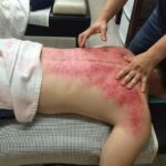 Gua Sha: La Tecnica Cinese per Sciogliere Tensioni e Drenare Tossine