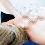 Coppettazione (Cupping): La Terapia a Ventosa per Muscoli e Dolore